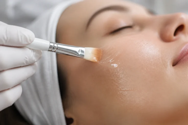 Soin du visage combinant peeling et mésolift pour une peau repulpée et lumineuse